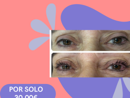 Lifting y tinte de pestañas